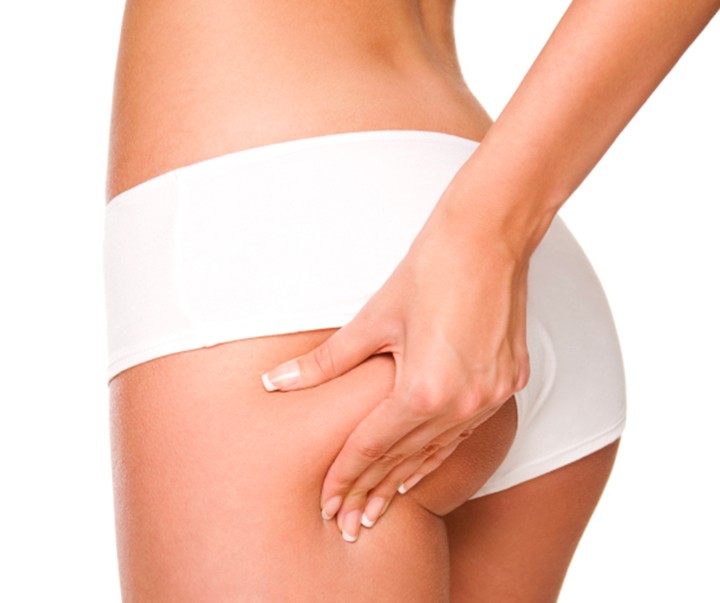 Les idées fausses sur la cellulite